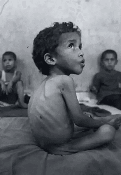 Fotografia em preto e branco mostrando uma criança palestina extremamente desnutrida, sentada de perfil sobre um colchão ou tecido simples. Seu corpo está magro até os ossos, com costelas e coluna visíveis; cabelos curtos e encaracolados, olhos grandes e expressivos voltados para cima, boca entreaberta. Ao fundo, duas outras crianças estão sentadas, desfocadas, em ambiente interno precário, possivelmente abrigo ou hospital improvisado. A imagem documenta as consequências humanas da crise humanitária em Gaza.